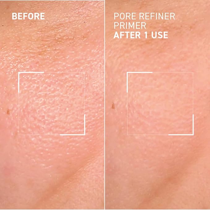 Dr. Brandt Pores No More, Pore Refiner Primer - Instantly Minimizes the Appearance of Pores, Absorbs Oil & Mattifies Shine - 0.5 fl oz
