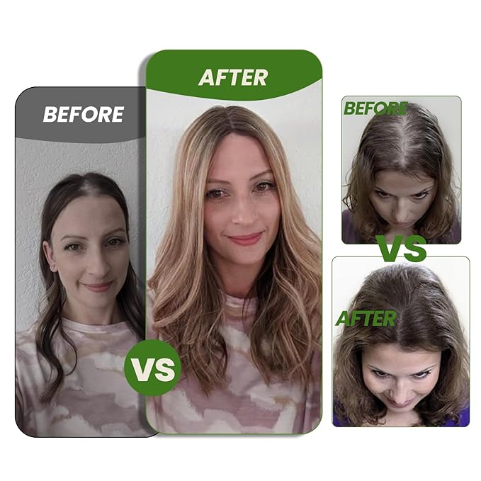 HAIR Real Human Hair Toppers for Women 150 Density 6x7inch 75 grams 16 inch medium dark brown for Women with Thinning Crown (#4 16inch)