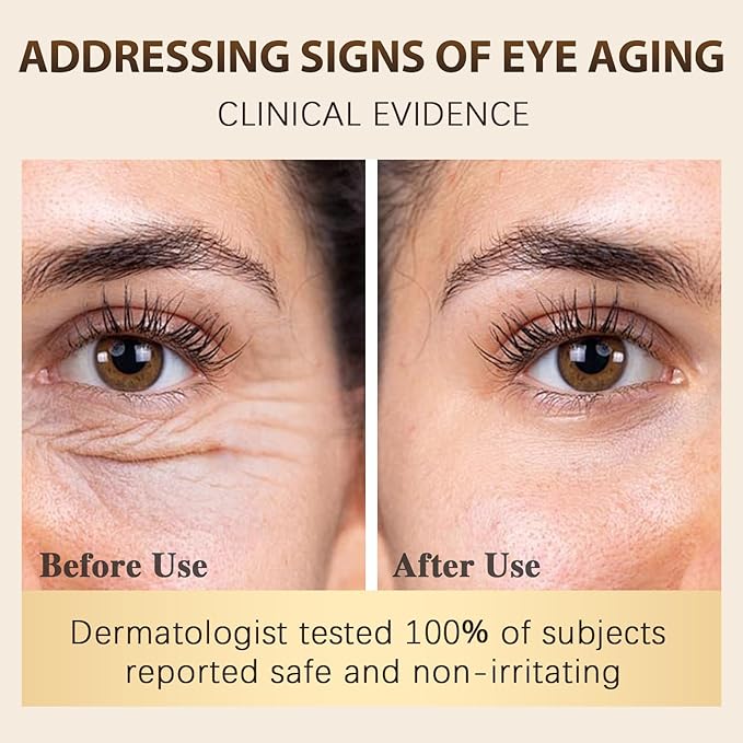 Vitality-Fill Boosting Eye Cream, Natural Anti Aging Under Eye Cream Lift & Firm,Reduce Wrinkles,Fine Lines,and Under Eye Bags,Dark Circles Under Eye Cream