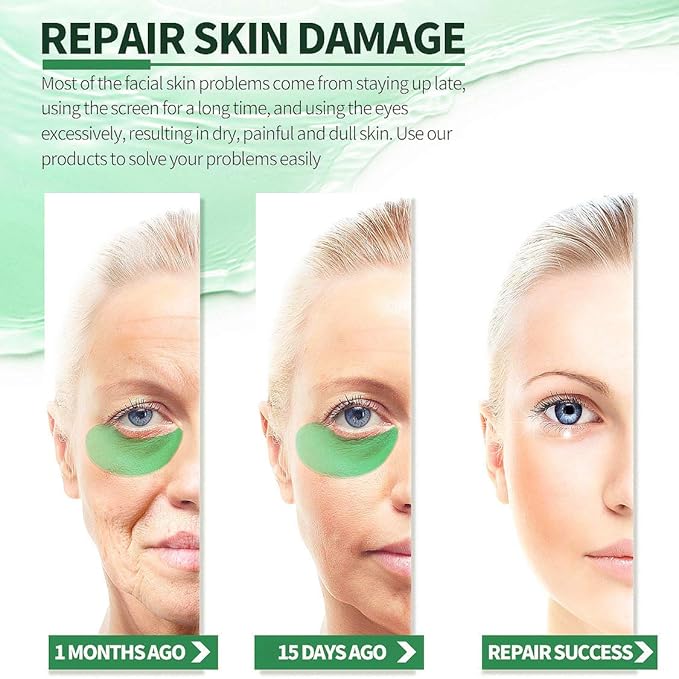 Seaweed Under Eye Masks, Moisturizing, Nourishing, Improving Dark Circles, Whitening, Wrinkles, Provides Protein, Vitamins, Collagen, Hyaluronic Acid, 30 Pairs