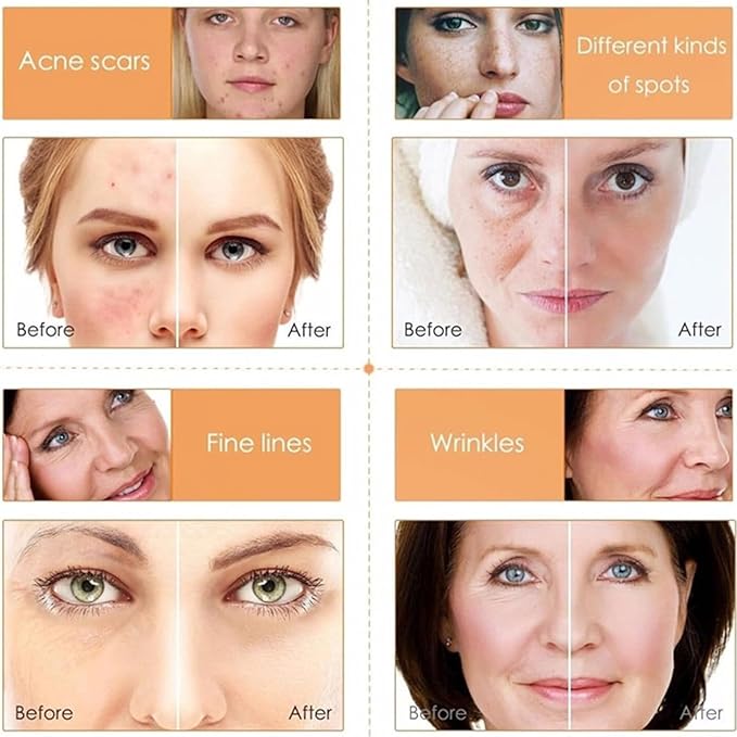 Vitamin C Skin Care Sets, 6Pcs Skin Care Products Set, Skin Care Gift Set for Women Girls, Hydrating Skincare Routine Set, Face Care Kit Includes Cleanser, Mask, Face Serum, Toner, Cream