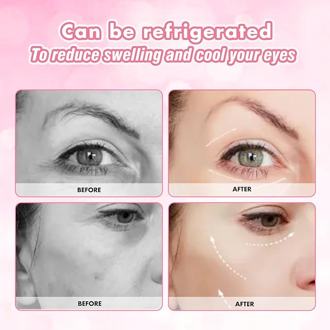 Under Eye Patches Silicone, 3 Pairs Reusable Under Eye Patches With Metal Eye Cream Applicator, Reusable Under Eye Mask Eye Pad For Minimize Fine Lines Wrinkles, Visible Metal Case