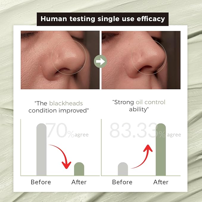 Purifying Green Tea Mask, Natural Facial Clay Mask Deep Pore Cleansing with Green Tea Extract and Portulaca Extract, for Clogged Pores, Detoxifies & Balance Oil, 3.52 fl.oz