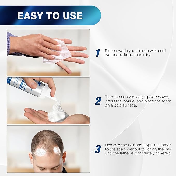 5% Minoxidil for Men Foam Hair Growth - Minoxidil Foam Hair Regrowth Treatment for Men, Topical Hair Loss Treatments, Extra Strength Thicker & Fuller Hair (2.11 Ounce x 2)