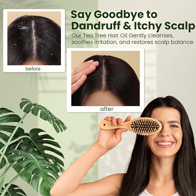 Natural Riches Tea Tree Oil for Hair - Blended with Vitamin E and Castor Oil for Hair Growth - Tea Tree Scalp Treatment for Dry Scalp - Lightweight Scalp Oil for Healthy, Strong Hair - 8 fl oz