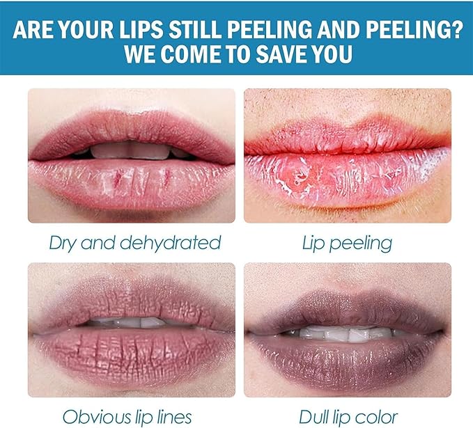 2PCS Natural Plant lip balm Pink Lips Serum Lightening Dark Lips Bleaching Essence Lip Balm Repair Fine Lines Brighten Moisture Exfoliator Lip Care (Orange)