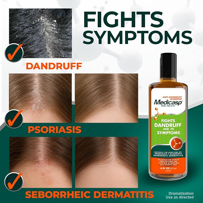 Medicasp Coal Tar Anti-Dandruff Shampoo, Alleviates Symptoms from 1st Wash, Treats Psoriasis, Seborrheic Dermatitis & Itchy Dry Scalp, Fights the Root Cause of Dandruff, Flakes Shampoo, 6 fl oz-3 Pack