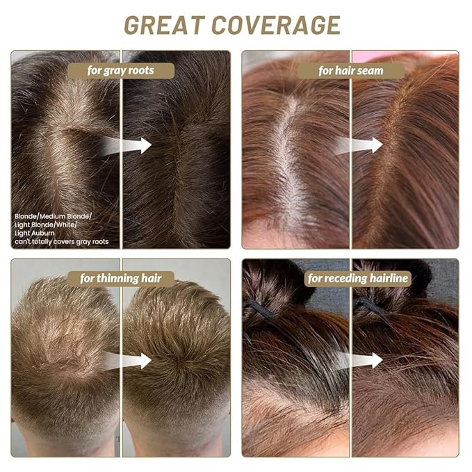 SOVONCARE Hairline Powder - Root Touch Up & Gray Hair Concealer for Men and Women, Instantly Covers Thinning Hair and Bald Spots, Natural-Looking Coverage Dark Blonde 0.35 oz