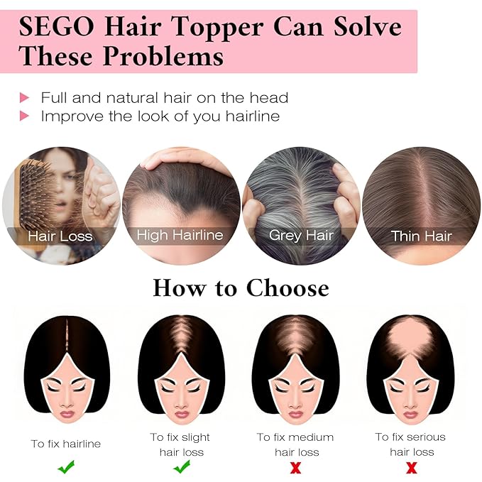 SEGO 100% Real Human Hair Toppers with Bangs for Women with Thinning Hair