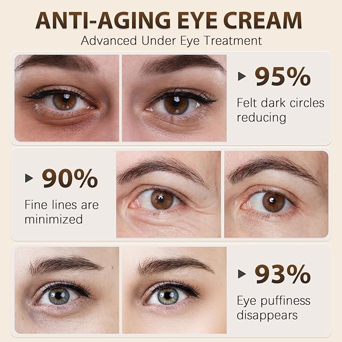 Vitality-Fill Boosting Eye Cream, Natural Anti Aging Under Eye Cream Lift & Firm,Reduce Wrinkles,Fine Lines,and Under Eye Bags,Dark Circles Under Eye Cream