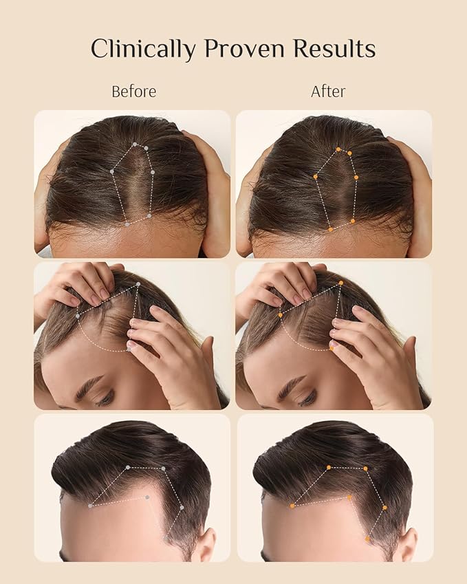 DR ZERO REDENICAL Hair Growth Shampoo for Women, 13.5 oz/400ml, Volumizing Thickening & Anti Hair Loss Regrowth Treatment, Clinically Tested for Hair Thinning with Redensyl, Japanese Hair Care Product