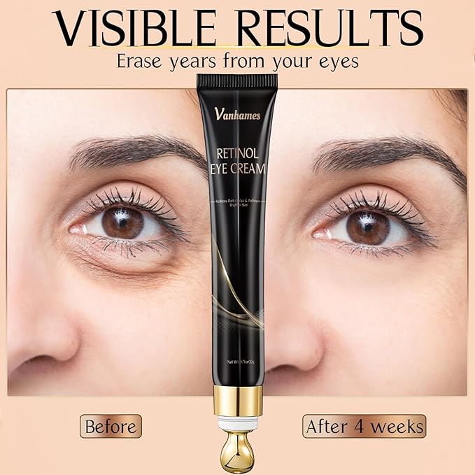 Retinol Caffeine Eye Cream, Under Eye Cream for Dark Circles and Puffiness, Anti Aging Eye Cream for Wrinkles, Eye Bags Treatment for Men and Women, 20g (Fragrance Free)