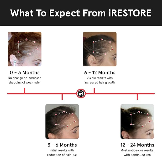iRestore Essential Laser Hair Growth System + Rechargeable Battery Pack - FDA Cleared Hair Regrowth for Men & Women with Thinning Hair