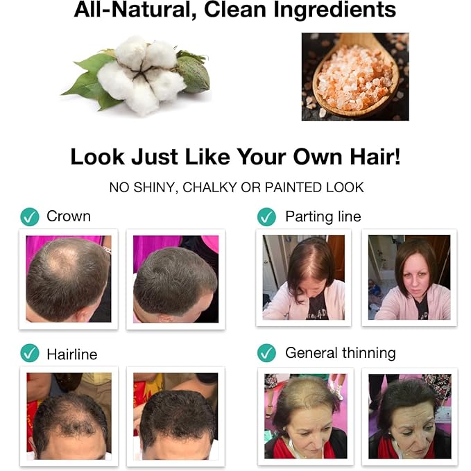 Hair Fibers For Hair Loss. Cover Bald Spot and Thinning Hair Instantly. Make Thin Hair Look 10X Fuller. All-Natural Hair Building Fiber. Trial Size (10-Day Supply). Dark Gray