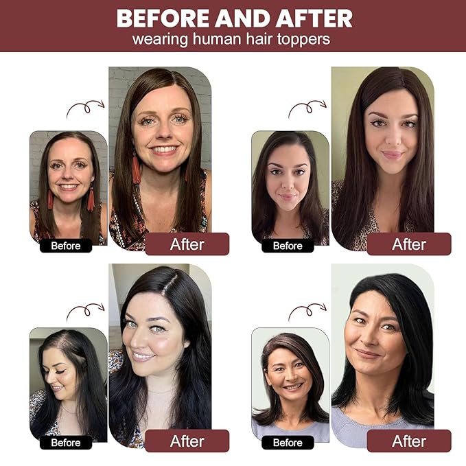 YAMI Real Human Hair Toppers for Women, 12 Inch, Dark Brown, Swiss Lace Base, Medium Density, Full Top Coverage, Clips Attachment
