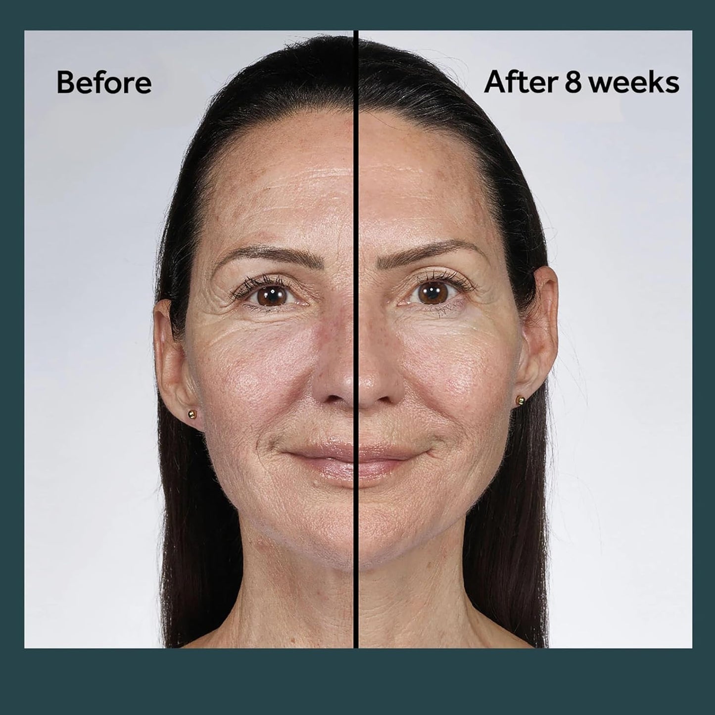 No7 Future Renew Damage Reversal Night Cream - Anti Aging Face Moisturizer - Infused with Peptide Technology to Reverse Visible Signs of Damage - Skin Barrier Repair for Dry Skin (1.69 Oz)