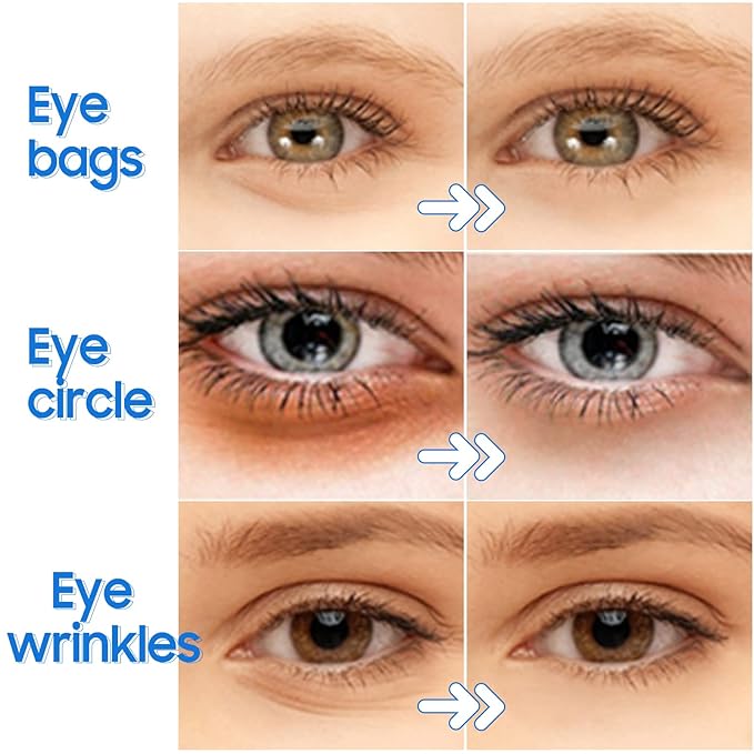 Under Eye Patches- 28 Pairs Blueberry Collagen Eye Mask Eye Patches for Reducing Puffy Eyes and Dark Circles, Anti Aging Gel Eye Pads Under Eye Mask, Blue