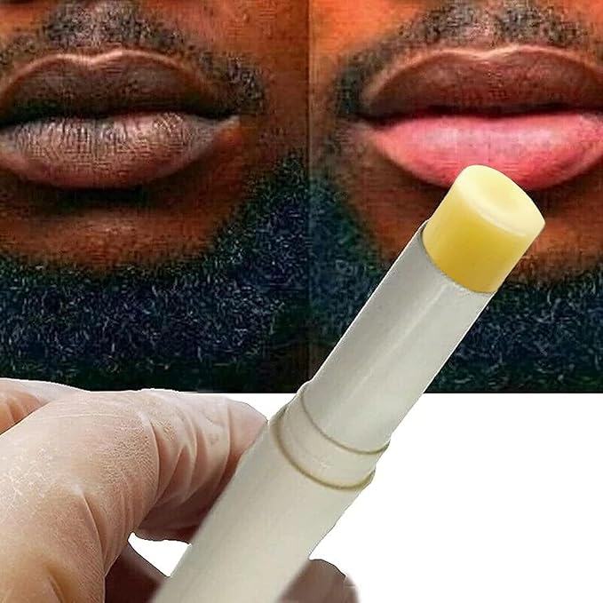 2pcs Lip Lightening for Dark Lips Lip Brightener for Smokers Dark Lip Treatment Lightening Cream for Pink Lips Lip Lightener for Smoker Lips Lip Lightening balm for Men and Women (Yellow)