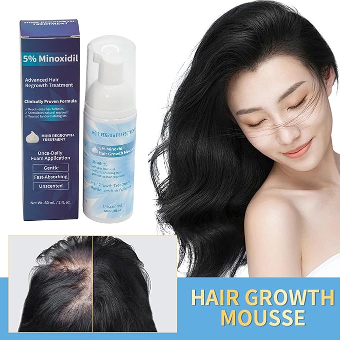 Minoxidil 5% Foam for Hair Growth, Topical Hair Loss Treatment for Men and Women, 3 Pack (2 oz Bottle) (1PC)