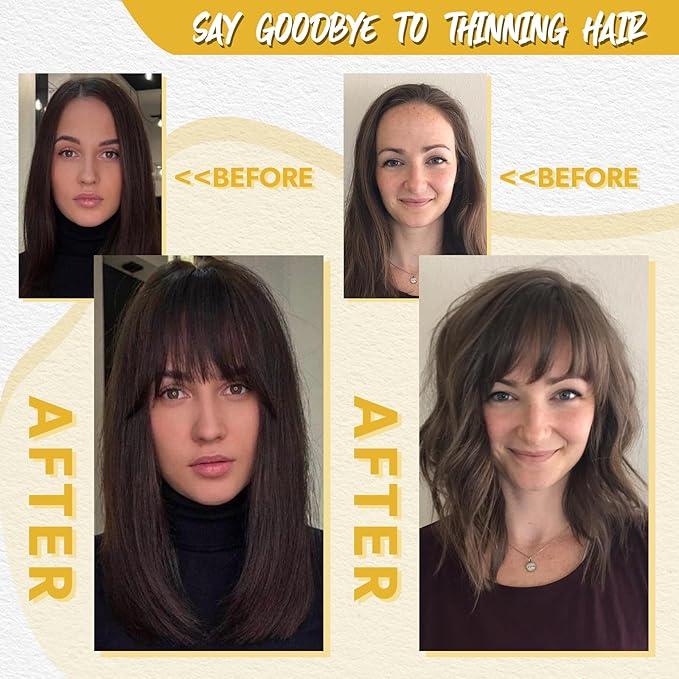 100% Real Human Hair Topper for Women Human Hair Bangs for Women 10 inch Dark Brown Hair Hoppers Clip in Bangs Swiss Base Hairpieces for Thinning Hair#2