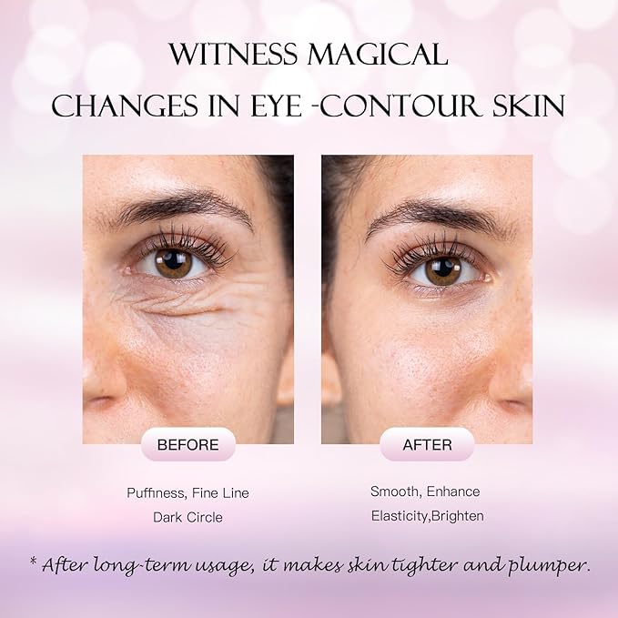 Under Eye Patches (60 Pcs) - 24K Gold Under Eye Mask - Collagen Eye Gel Pads for Removing Dark Circles, Puffiness & Wrinkles Refresh Your Skin