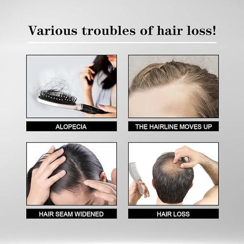 5% Minoxidil Hair Liquid for Men & Women, 2 x 3ml, with Ginseng & Ginger Root Extract - Hair Growth Supporting Treatment for Thinning Hair, Scalp Care Serum to Help Reduce Hair Loss Appearance
