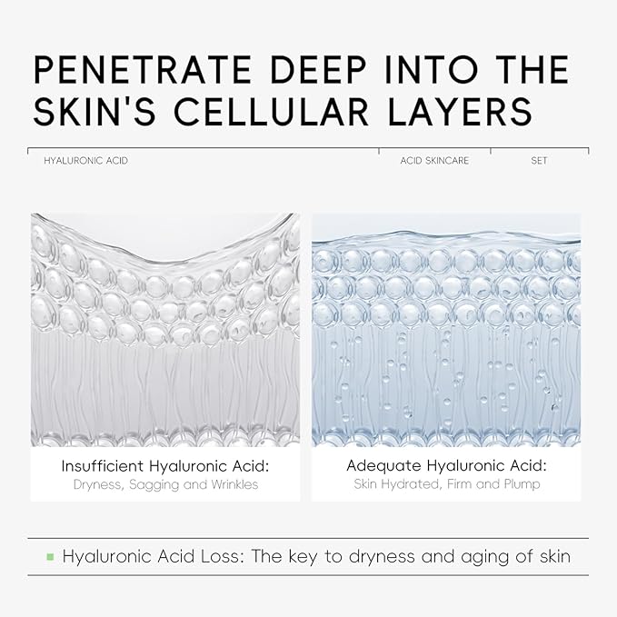 Hyaluronic Acid Skin Care Set, Hydration Kit for Women Teen Girls, Low pH Cleanser, Moisturizer, Serum, Eye Cream, Anti Aging, Firming, Travel Size Facial Care Gift Set for Dry Sensitive Skin