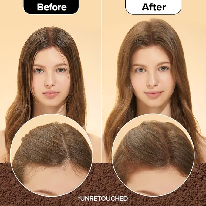 I DEW CARE Biotin Clarifying Dry Shampoo - Tap Secret Brown | Strengthening & Volumizing, Powder Type, Refillable, Travel size, Non-aerosol, Brunette, Korean Ginseng, Preppy Stuff, 0.26 Oz