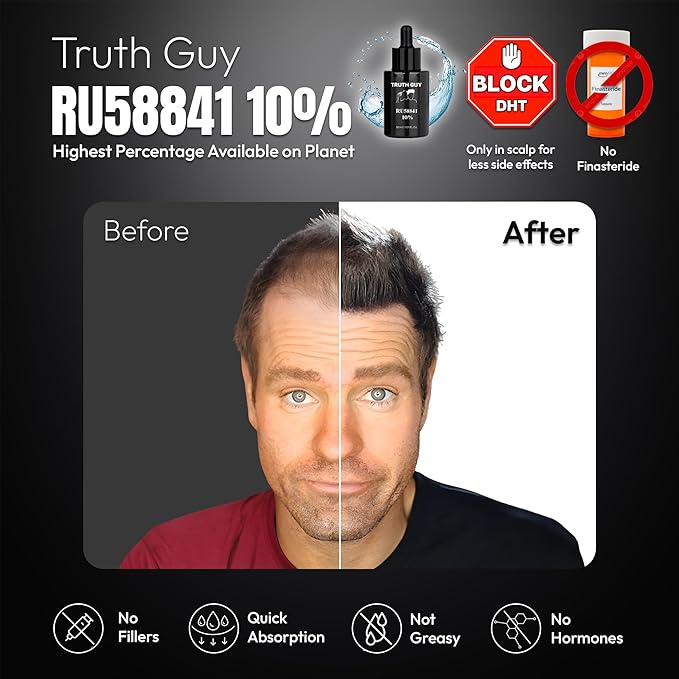 Truth Guy RU58841 10% Hair Serum for Men – Powerful DHT Blocker with Maximum Strength – Targets Male Pattern Thinning and Receding Hairline – Promotes Fuller, Healthier-Looking, Stronger Hair – 30 ml