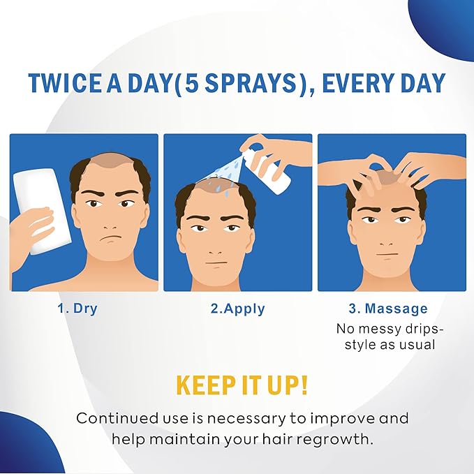 Minoxidil for Men and Women Hair Growth: 5% Minoxidil Spray Hair Regrowth Treatment Serum Stop Hair Thinning and Hair Loss For Stronger Thicker Longer Hair 100ml