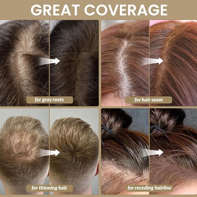 VOLLUCK Root Touch up Powder, Instant Hairline Powder for Thinning Areas and Gray Hair Coverage, Natural and Non-greasy Root Cover up for Women and Men (Auburn, 0.14 Ounce)