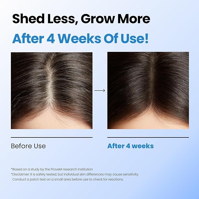 Scalpy Hair Growth Serum for Men & Women for Hair Loss & Regrowth | Scalp Treatment with Salicylic Acid, Menthol, Dexpanthenol | Non-Greasy, Lightweight (1.34 Fl Oz)