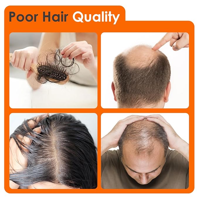 Hair Growth Device LS-D630 - Promote Hair Growth in Males and Females with Androgenetic Alopecia