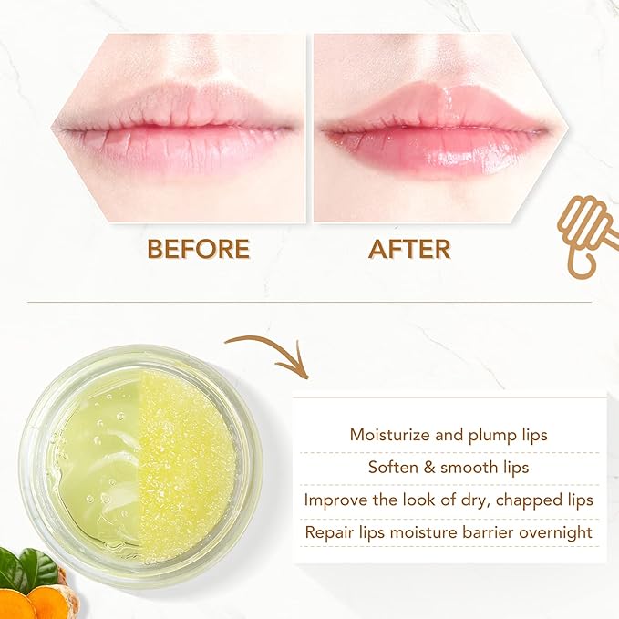 ANAIRUI Lip Therapy Set - Lip Care Kit - Includes Sugar Lip Scrub & Jelly Lip Sleep Mask, Lips Balm & Moisturizer, Dark Lip Care, Moisturizing for Fuller, Softer Lips (Turmeric & Honey)