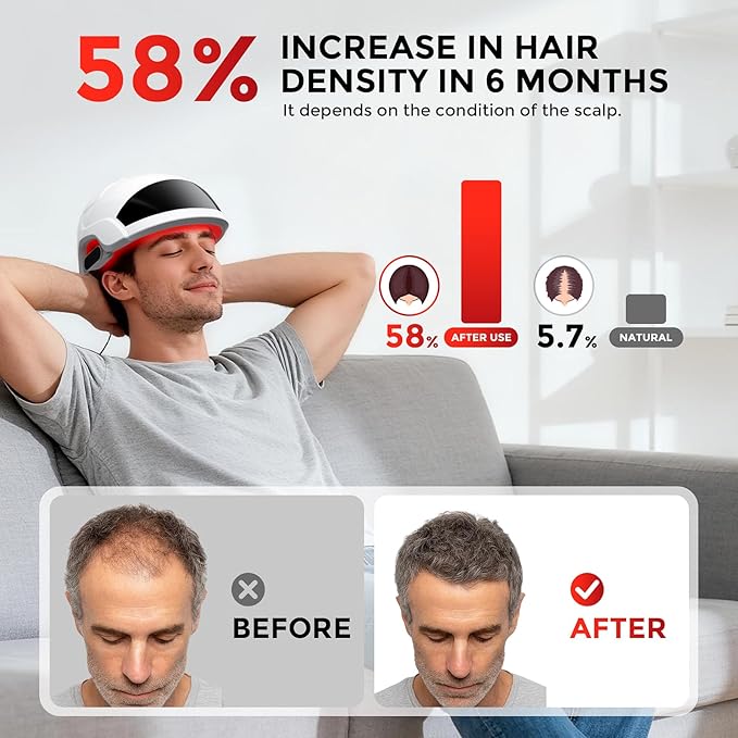 Red Light Therapy for Hair Growth Laser Cap - FDA Cleared Laser Therapy Device - Promotes Hair Regrowth Alopecia Treatment for Men & Women