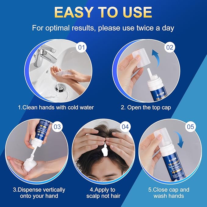 5% minoxidil foam for men-5pack， Infused with Biotin, Hair Growth Treatment, Supports Thicker and Fuller Hair & Beard (10.5oz, 5 Month Supply)