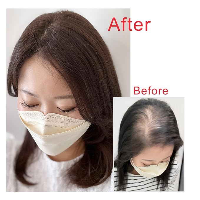 Real Human Hair Topper Double-Monofilament Top Hand-Tied Hair Pieces Mid Length for WomenThinning Hair BHADS812 (BL Natural Black × Hair Length:9.8"(25cm), Base Size:3.1"×4.7"(8cm×12cm))