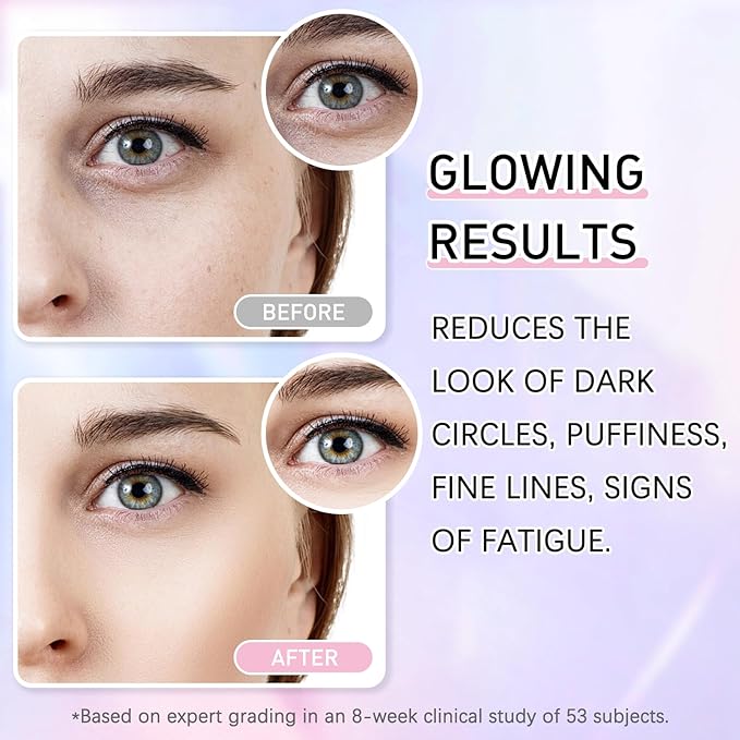 5% Caffeine Eye Cream Eye Serum Kit for Dark Circles Under Eye Treatment For Puffiness Bags And Wrinkles Eye Cream Anti Aging Eye Serum & Eye Roller 2 Fl Oz