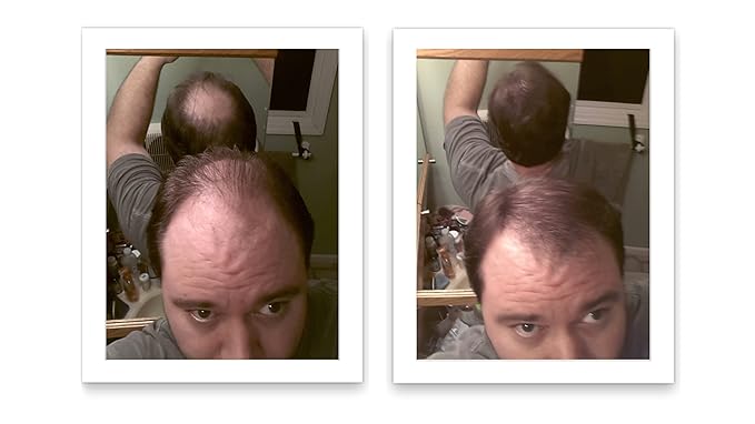 Hair Building Fiber. Cover Bald Spot and Thinning Hair Instantly. 10X Fuller Hair. All-Natural, Organic Hair Loss Concealer. Trial Size (10-Day Supply). Medium Brown