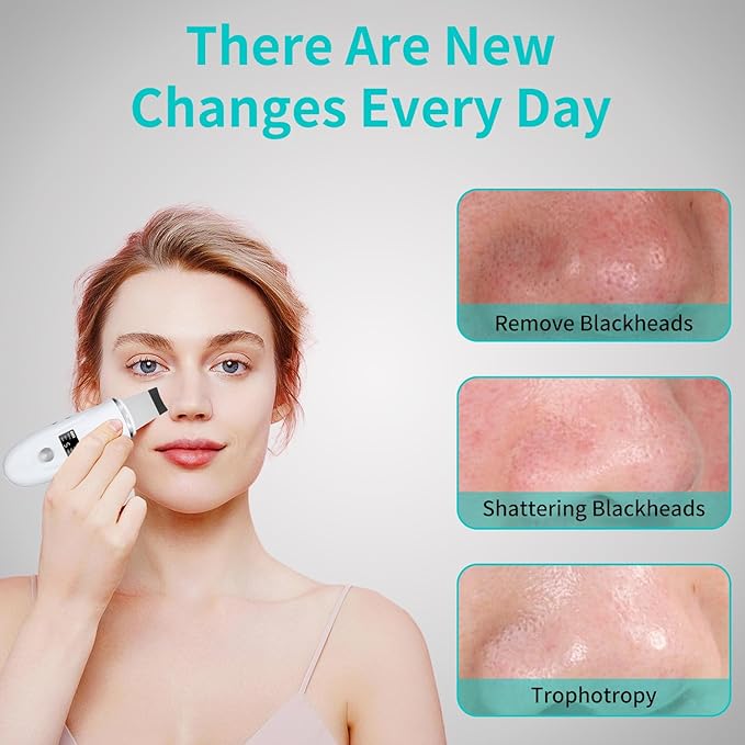 Skin Scrubber Face Spatula - 4-in-1 Deep Cleansing Tool for Pore Extraction, Fast Charging Dock Blackhead Remover Face Spatula for Facial Skincare Women Gift (White)