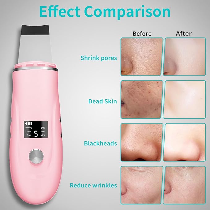 Skin Scrubber Facial Spatula - 4-in-1 Deep Cleansing Tool for Pore Extraction, Fast Charging Dock Blackhead Remover Face Spatula for Facial Skincare Women Gift (Pink)
