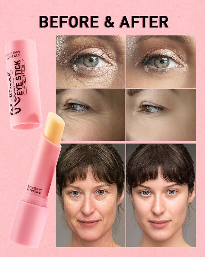 Under Eye Stick For Puffiness: Retinol Under Eye Balm Reducing Eye Bags and Dark Circles - Eye Cream for Fine Lines Wrinkles and Puffiness, Eye Treatment for Late Nights, Overtime and Makeup Prep