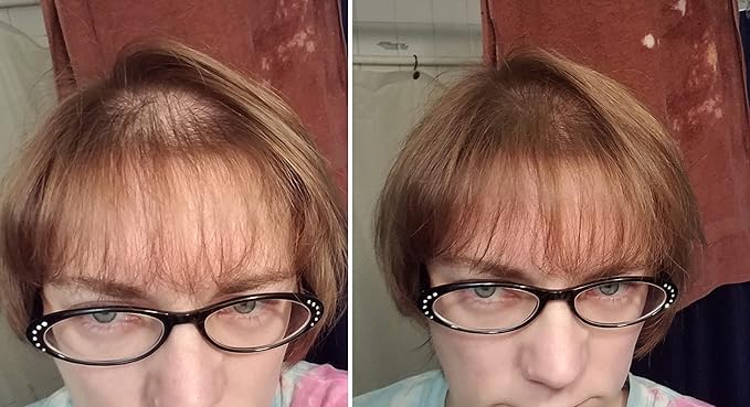 Quick Fix For Thinning Hair and Bald Spot. Get 10X Fuller Hair Instantly. All-Natural Hair Building Fiber For Hair. Trial Size (10-Day Supply). Light Brown