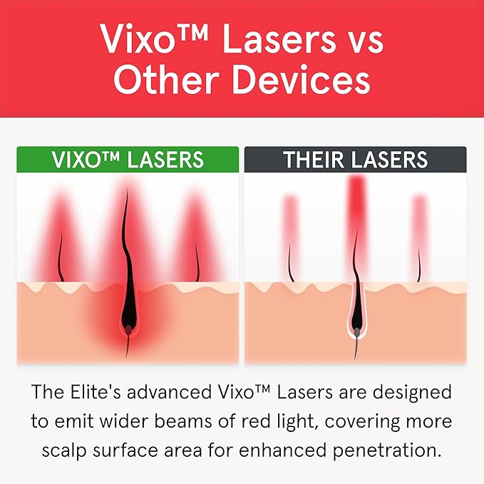 iRestore Elite - Laser Red Light Therapy for Hair Growth System - FDA Cleared Hair Loss, Hair Thinning & Alopecia Treatment for Men & Women - Laser Cap for Hair Regrowth Stimulates Denser Fuller Hair