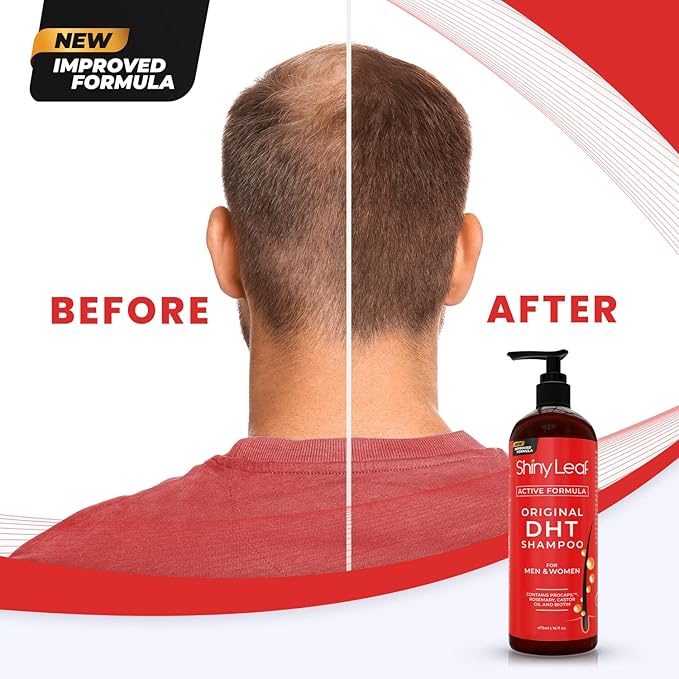 DHT Blocker Shampoo and Conditioner - For Women And Men, Made In USA, Anti-Hair Loss Treatment, With Biotin, Castor Oil, Rosemary Oil and Procapil, For Thinning Hair And Hair Loss