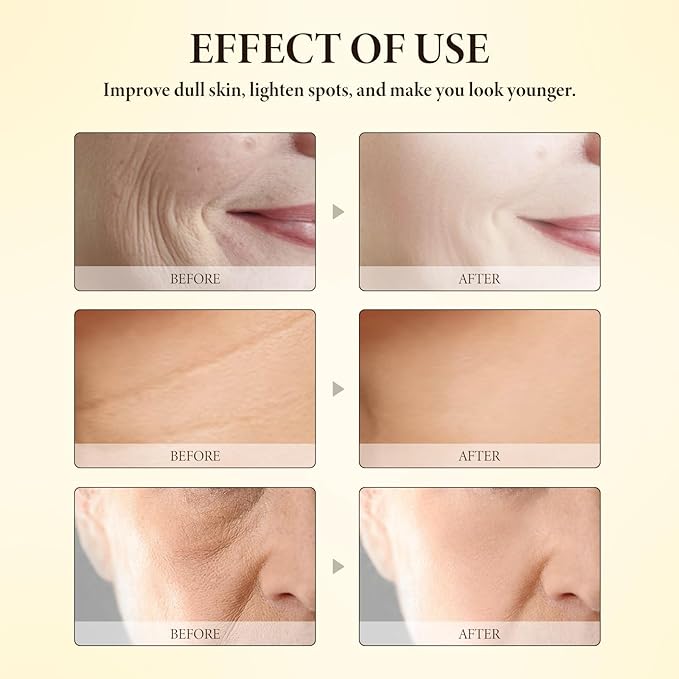 Bee Venom SkinCare Set, Includes New Zealand Bee Venom Face Lotion, Bee Venom Essence, Bee Venom Face Cream, Bee Venom Eye Cream, Anti-Wrinkle, Hydrating & Firming, Plant-Based Formula