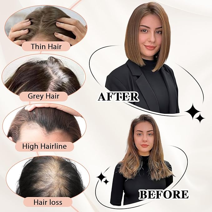 starluck Hair Toppers for Women Real Human Hair 5"*5.5"Large Coverage Gray Brown & Platinum Blonde No Bangs 100% Real Human Hairtoppers for Women with Thinning Hair Cover Gray Roots
