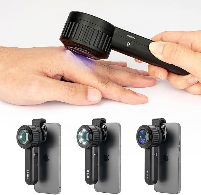 IBOOLO DE-3100 PRO Polarized No-Polarized and 365nm UV Light Dermatoscope, Handheld Portable Professional dermatoscopy