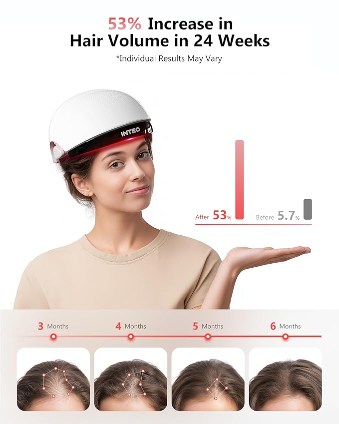 Red Light Therapy for Hair Growth, Laser Hair Growth Cap for Hair Loss, Rechargeable Battery- FDA Cleared Hair Growth for Men & Women, Wireless Red Light Hair Therapy, 162 Lasers
