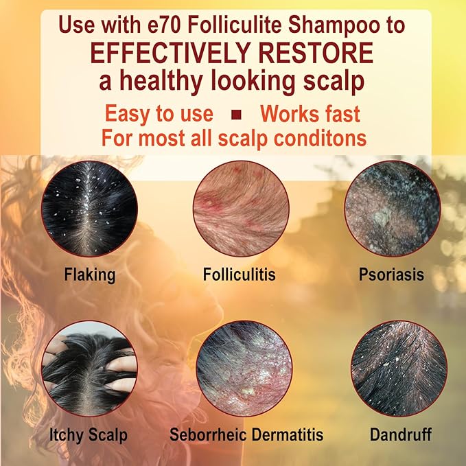 Folliculitis Treatment Conditioner with 3% BHA, Salicylic Acid, Tea Tree Oil & Chamomile Extracts - Anti Itch for women & men with Irritated Flaky Scalp Acne Treatment, Made in USA by e70, 8 fl oz